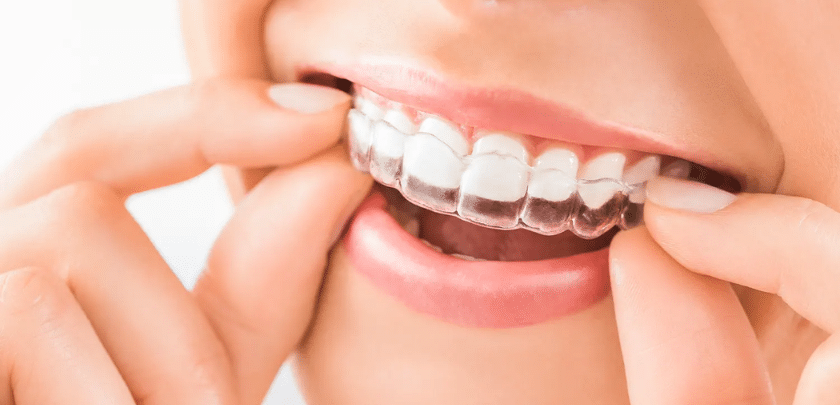4 Ways You Can Enjoy Coffee When Wearing Invisalign