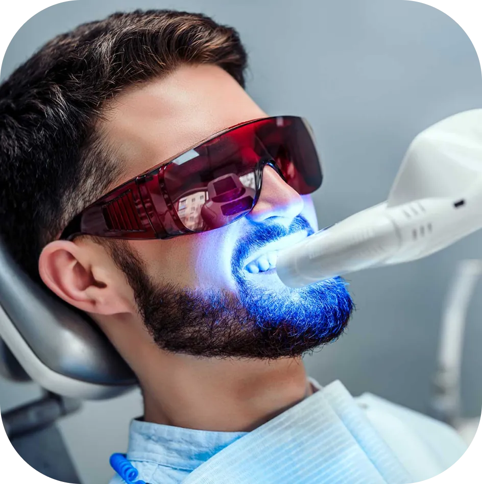 Teeth Whitening Encino CA