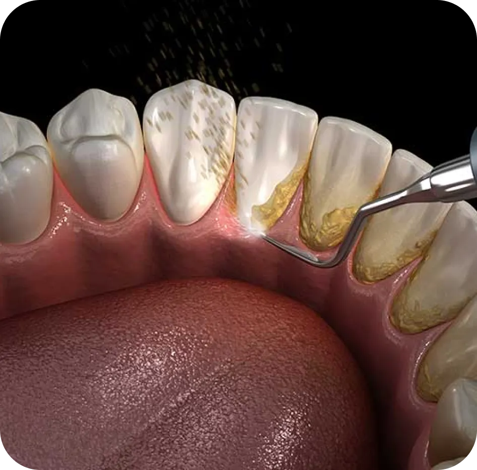 Encino Dental Esthetics
