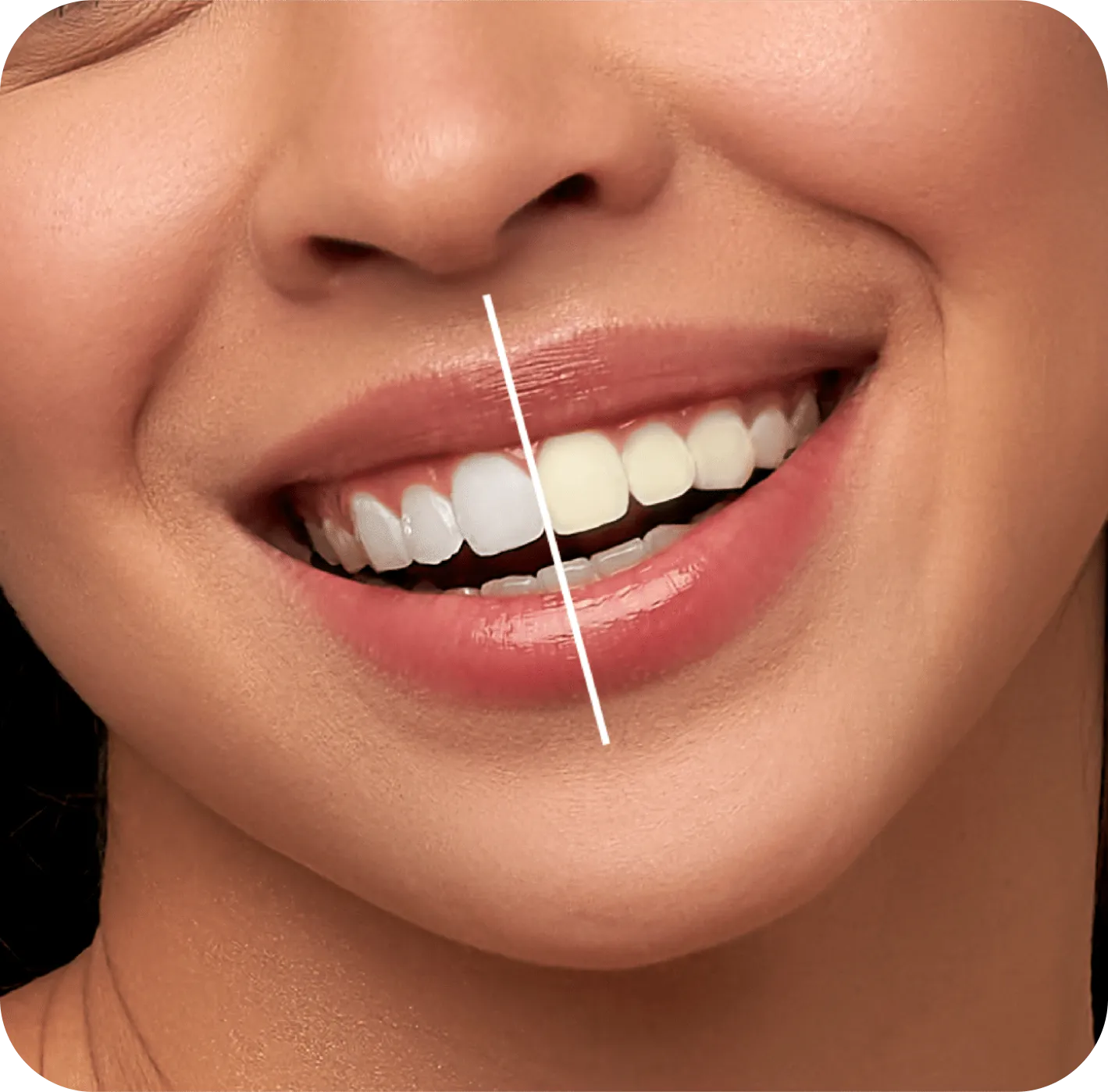 Encino Dental Esthetics