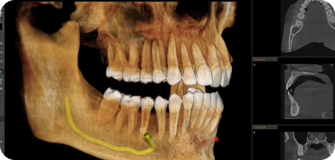 Encino Dental Esthetics