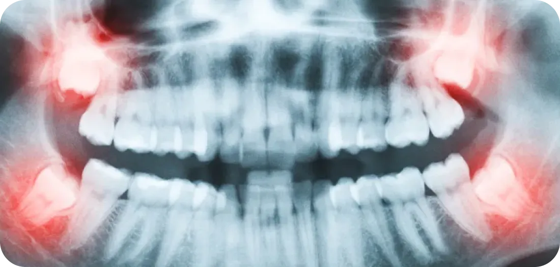 Encino Dental Esthetics