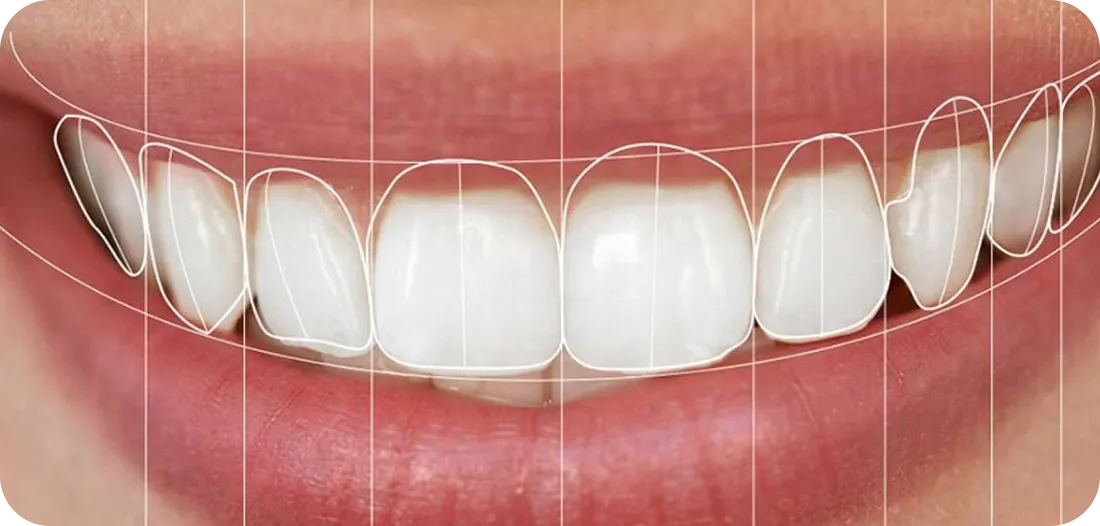 Encino Dental Esthetics