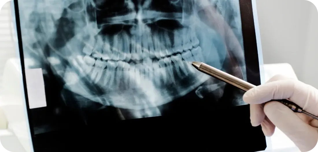 Encino Dental Esthetics