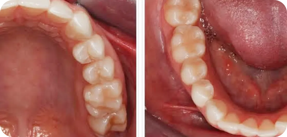 Encino Dental Esthetics