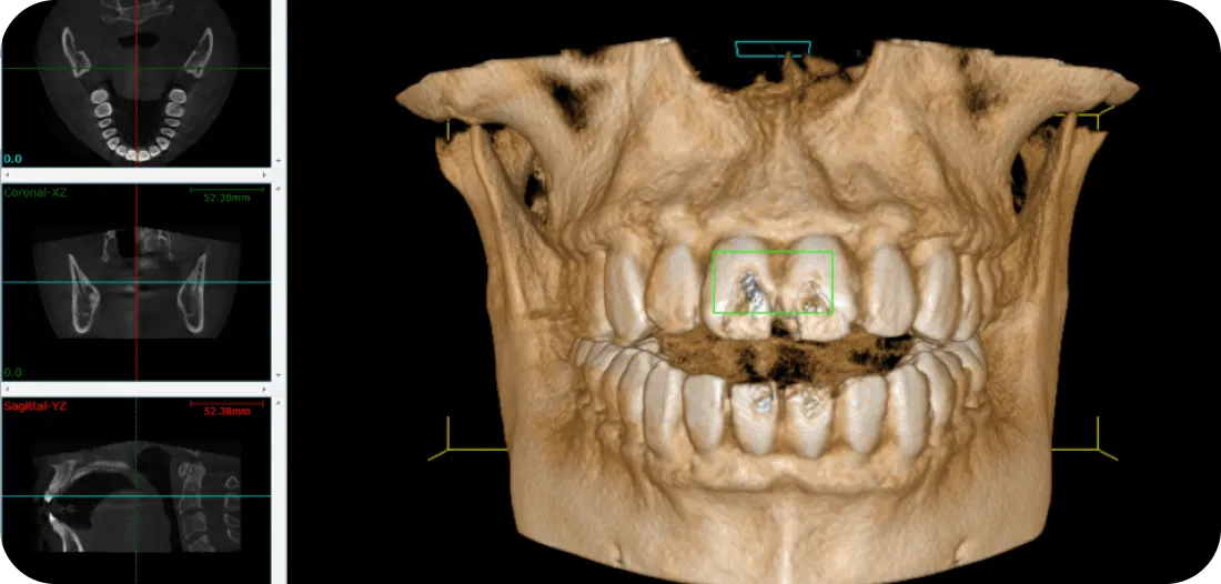 Encino Dental Esthetics