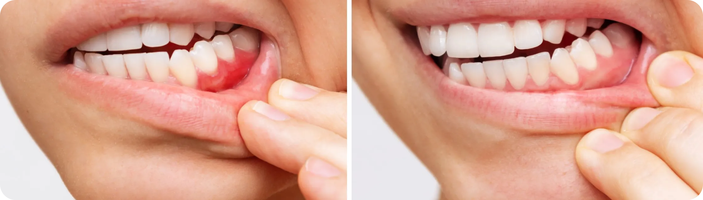 Encino Dental Esthetics