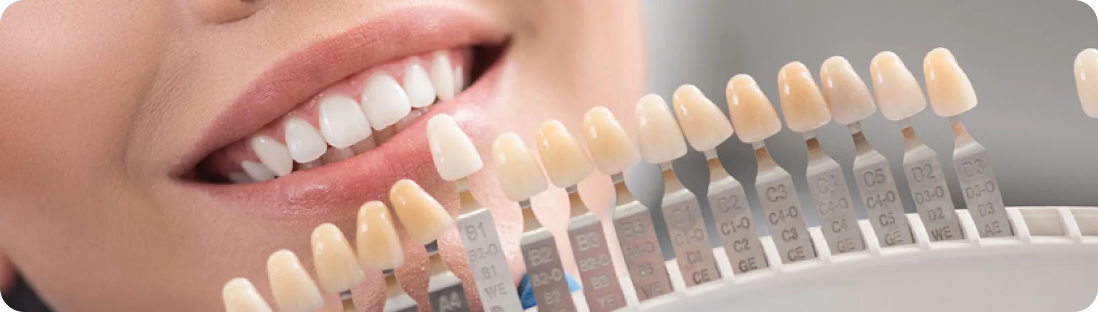 Encino Dental Esthetics