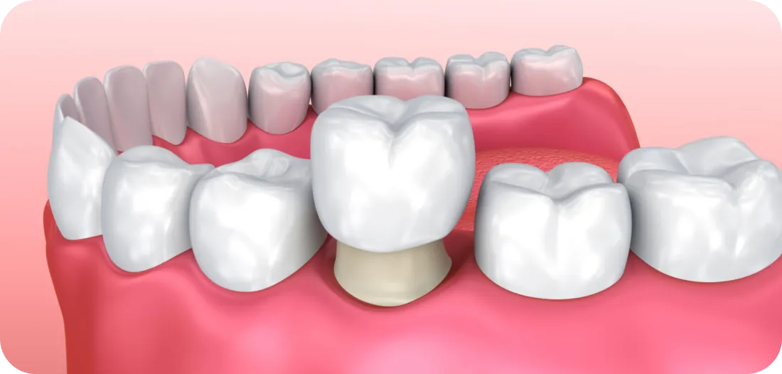 Encino Dental Esthetics