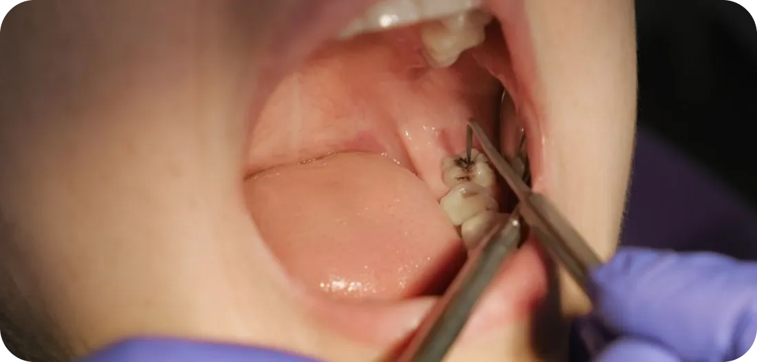 Encino Dental Esthetics