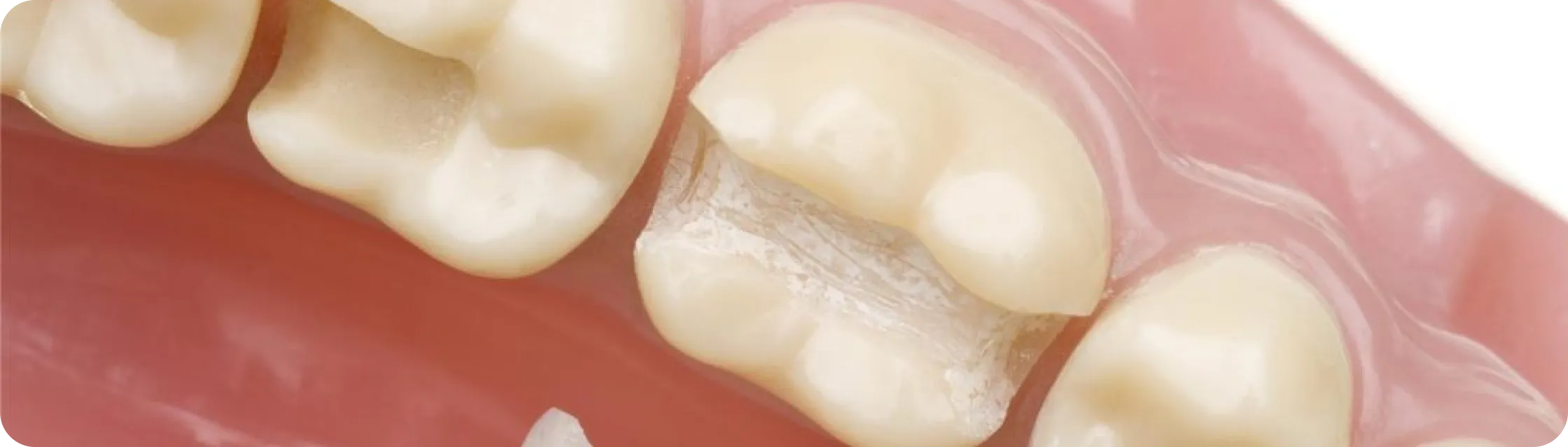 Encino Dental Esthetics