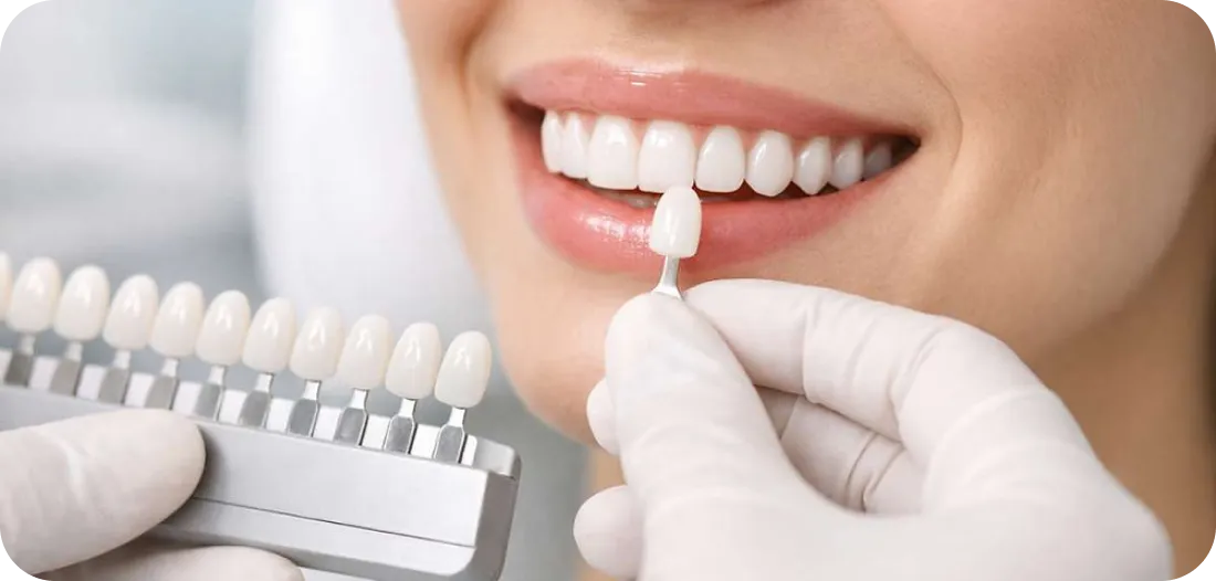 Encino Dental Esthetics