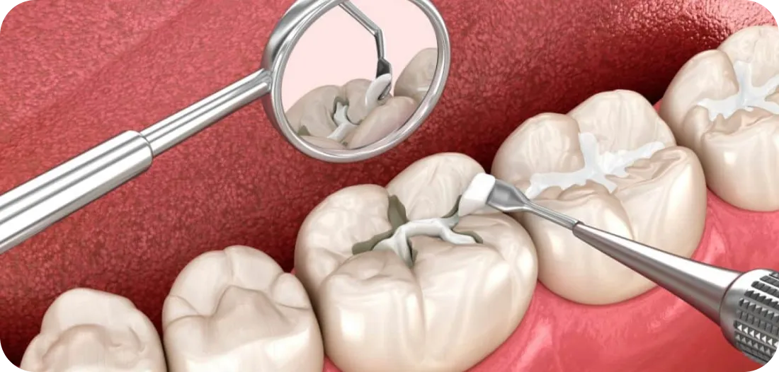 Encino Dental Esthetics