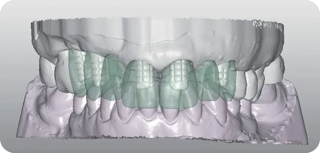 Encino Dental Esthetics