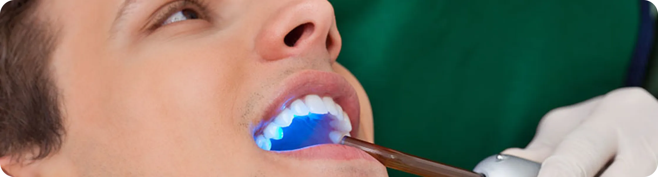 Encino Dental Esthetics