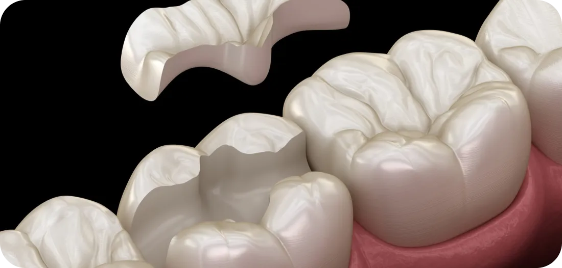 Encino Dental Esthetics