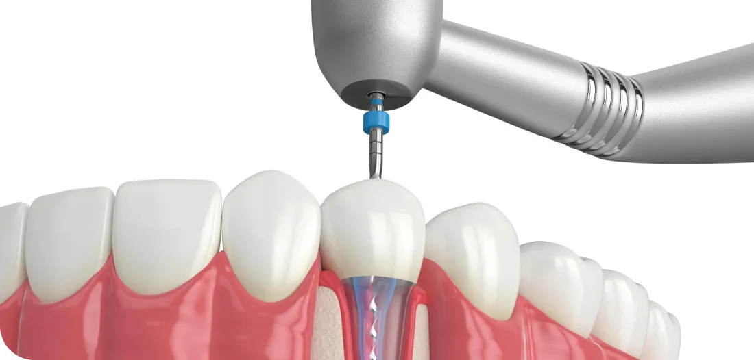 Encino Dental Esthetics