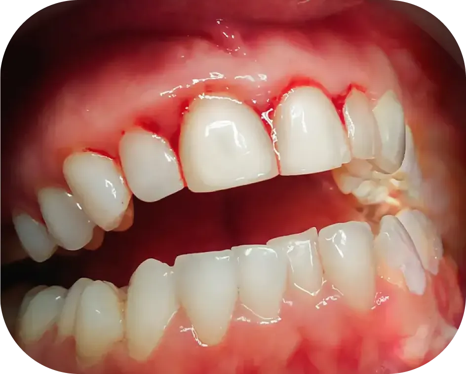 Encino Dental Esthetics