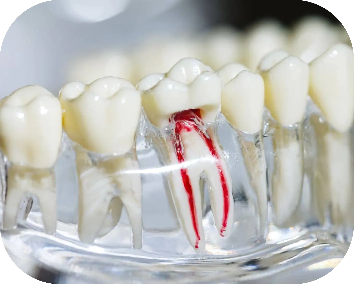 Encino Dental Esthetics