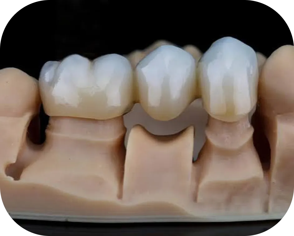 Encino Dental Esthetics