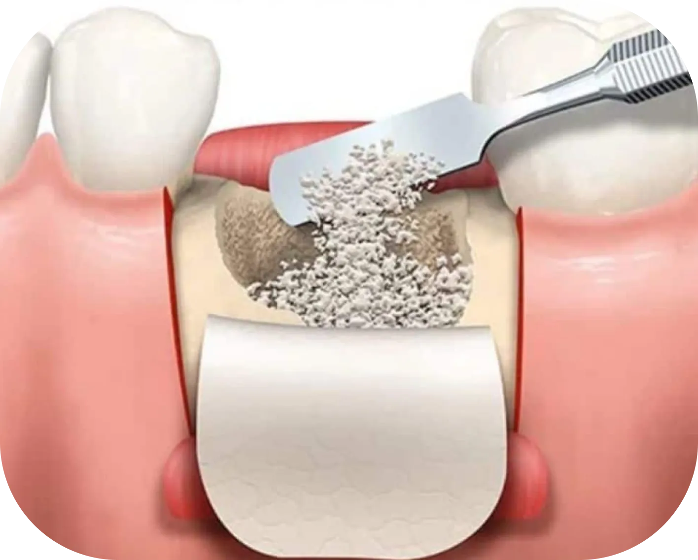 Encino Dental Esthetics