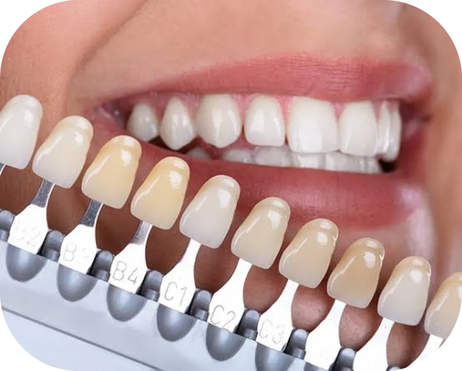 Encino Dental Esthetics
