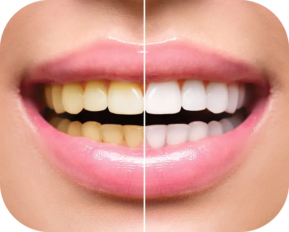 Encino Dental Esthetics