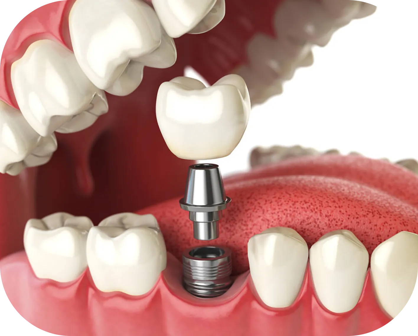 Encino Dental Esthetics