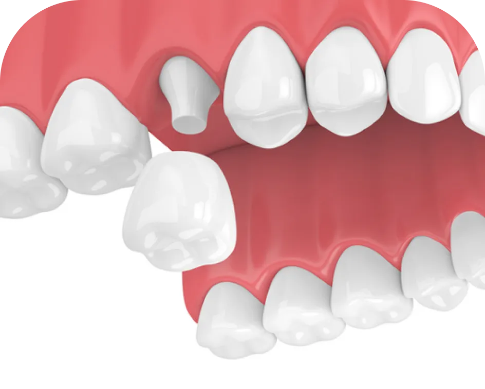 Encino Dental Esthetics