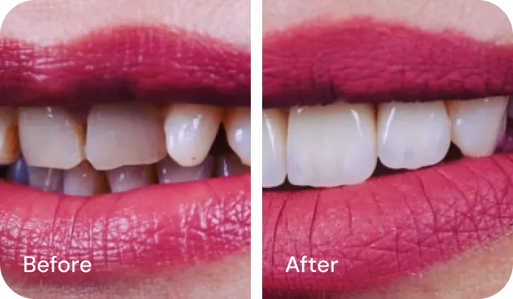 Encino Dental Esthetics