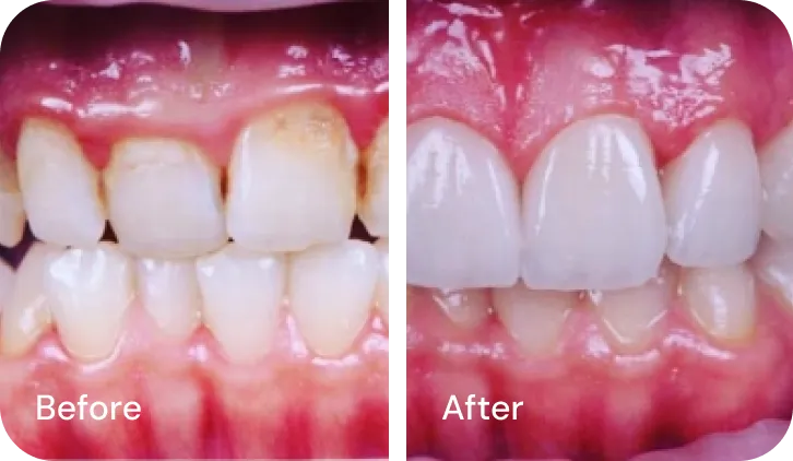 Encino Dental Esthetics