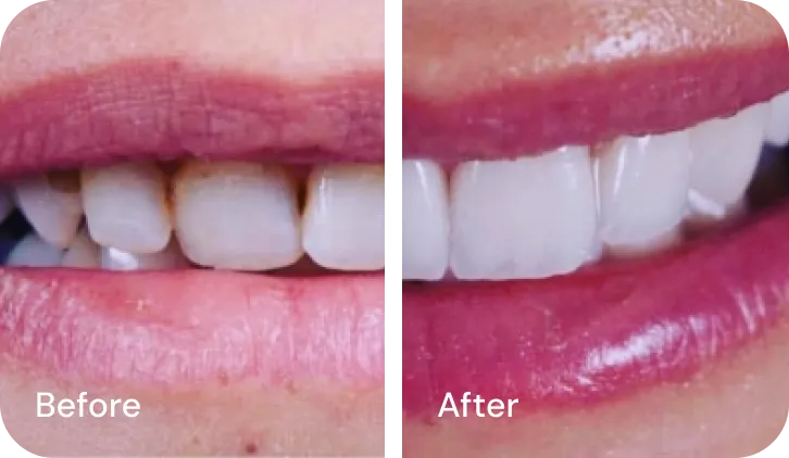 Encino Dental Esthetics