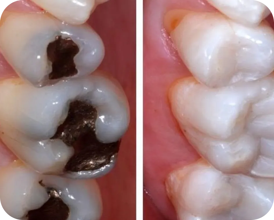 Encino Dental Esthetics