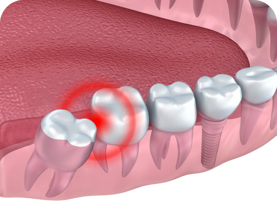Encino Dental Esthetics