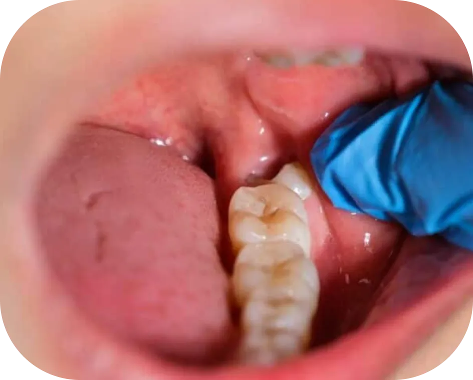 Encino Dental Esthetics