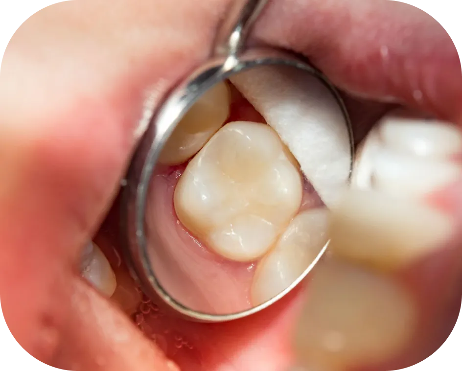 Encino Dental Esthetics