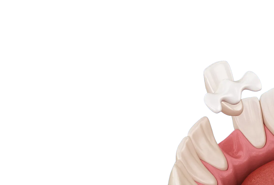 Encino Dental Esthetics