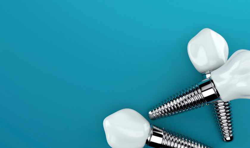 Science Behind Dental Implants