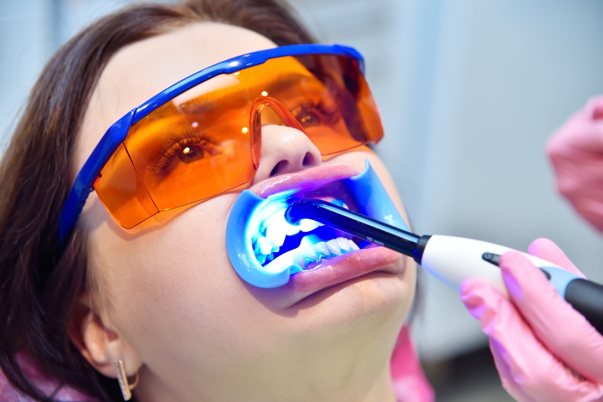 Teeth-Whitening-Encino
