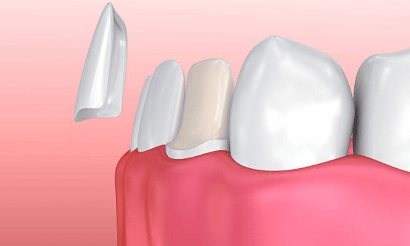 Cosmetic Dentistry