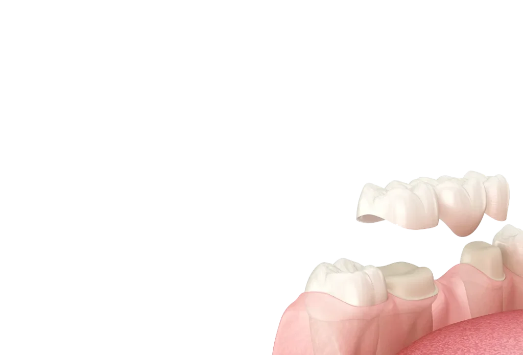 Encino Dental Esthetics