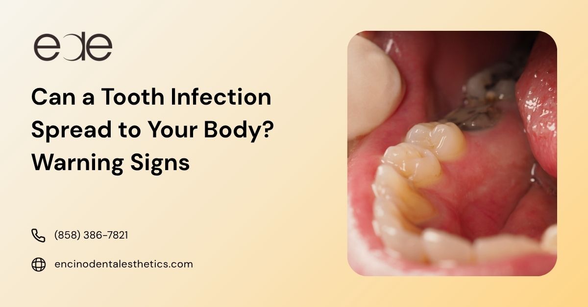 Can a Tooth Infection Spread to Your Body? What You Need to Know