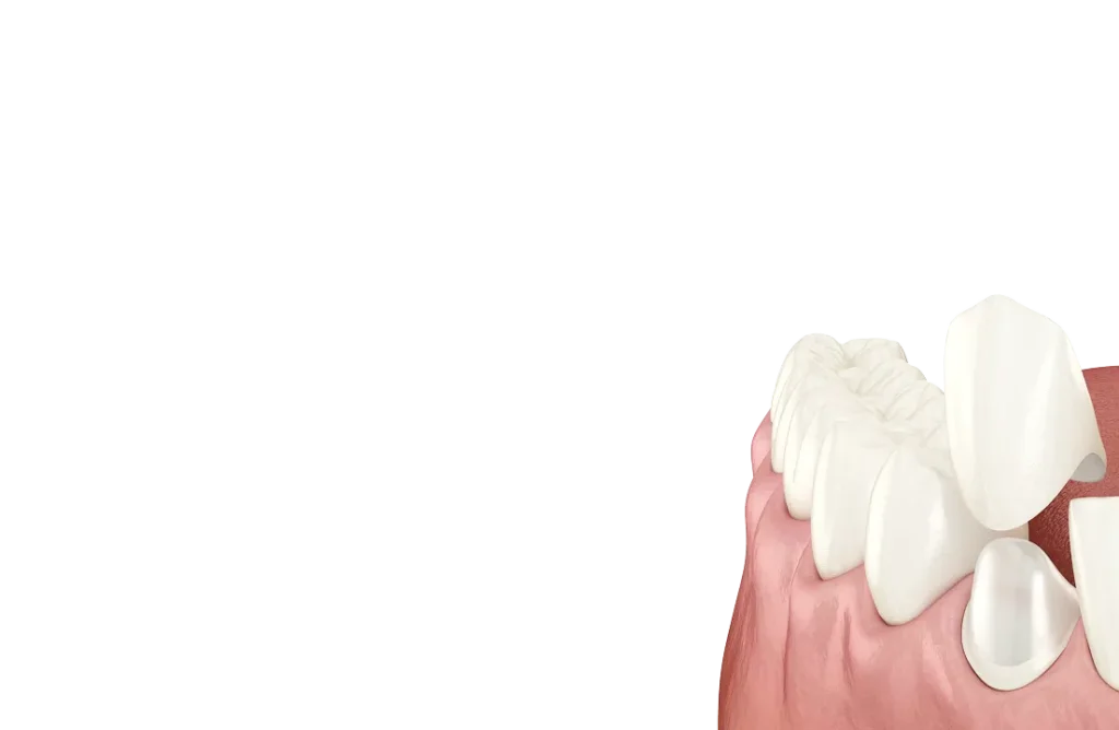 Encino Dental Esthetics