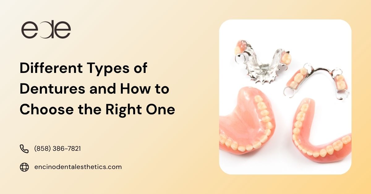 Dental prosthetics including removable partial and full dentures for missing teeth