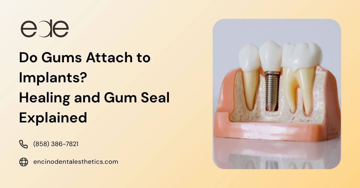 Dental implant structure illustrating gum attachment and oral healing process