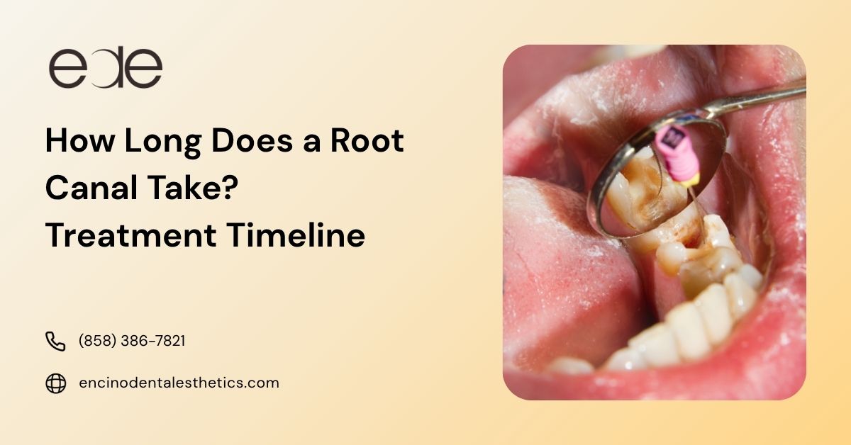 Root canal treatment being performed on a back tooth with dental instruments.