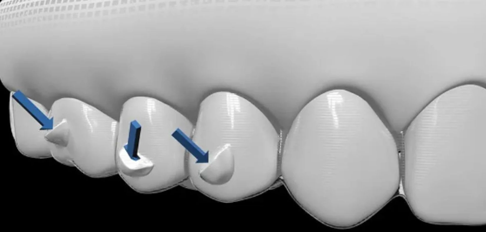 Encino Dental Esthetics