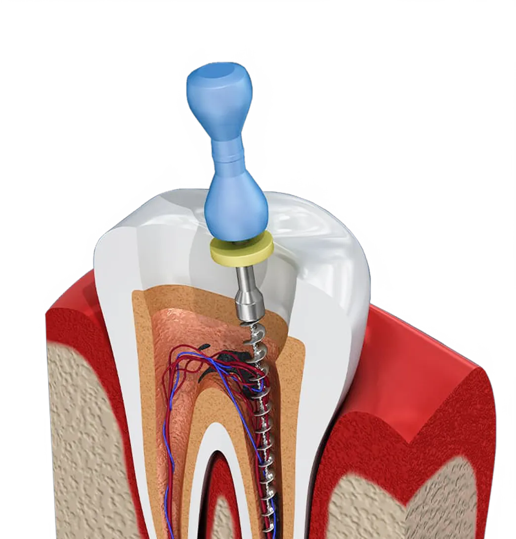 Encino Dental Esthetics