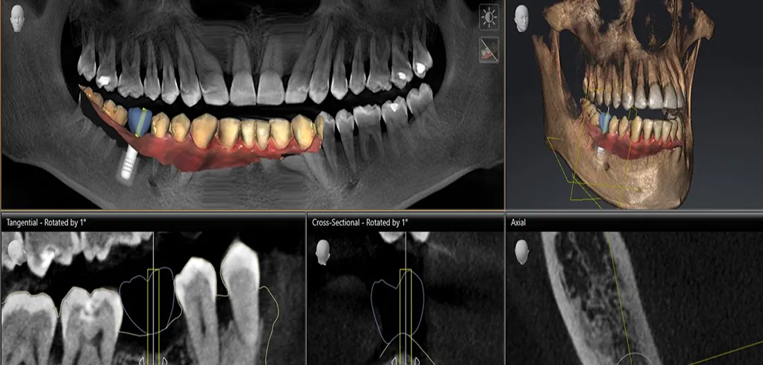 Encino Dental Esthetics
