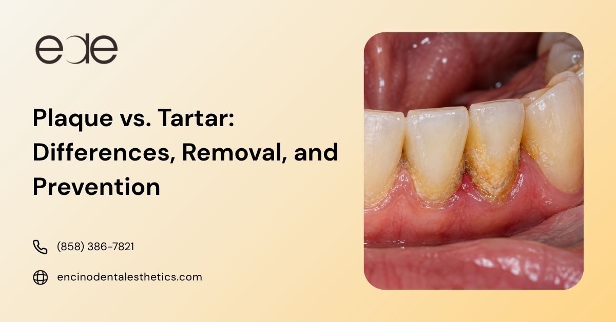 Close-up of tartar buildup along the gumline of lower teeth.